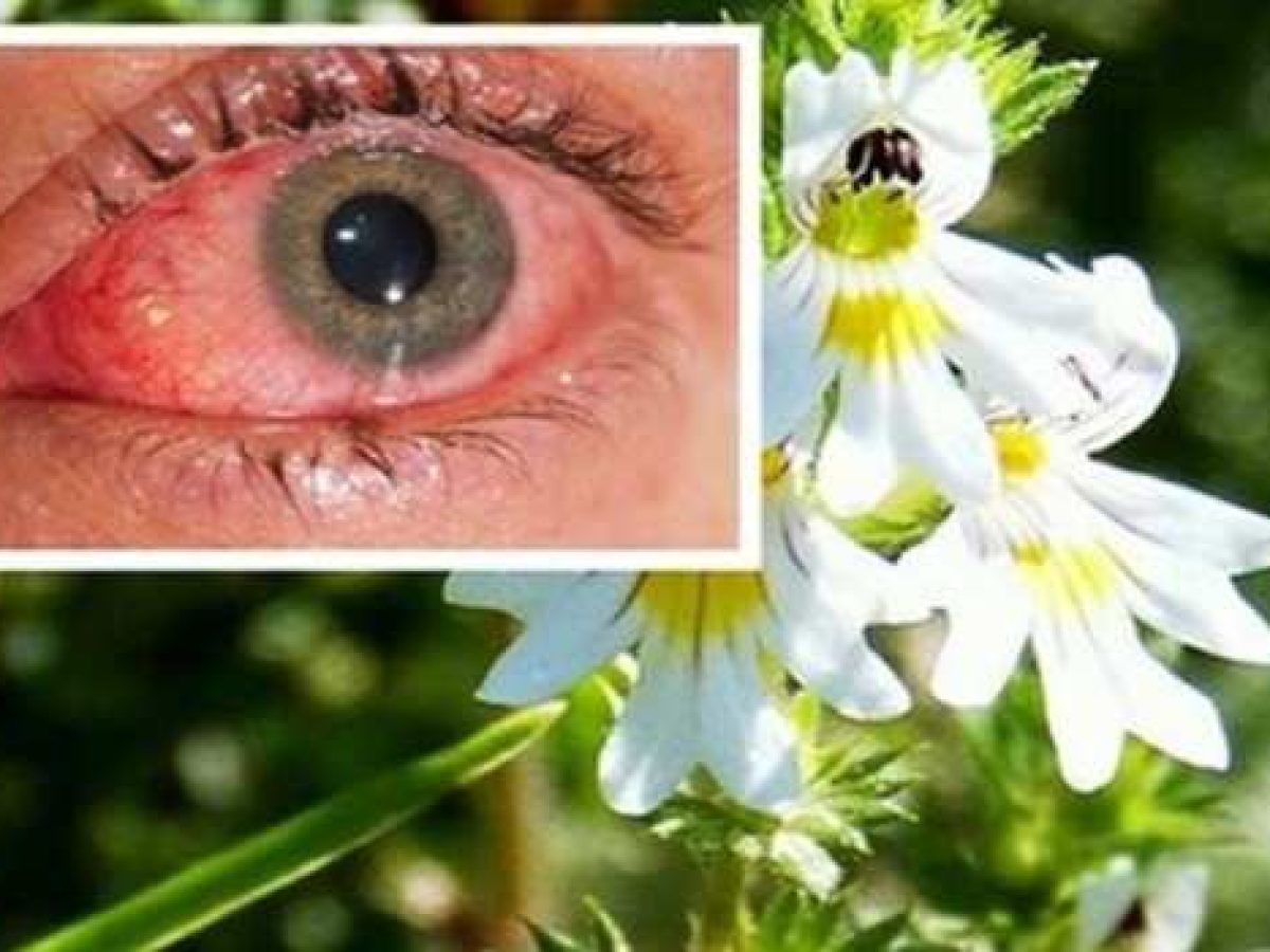 Το απίθανο βότανο που βελτιώνει την όραση ακόμα και σε άτομα άνω των 70 ετών